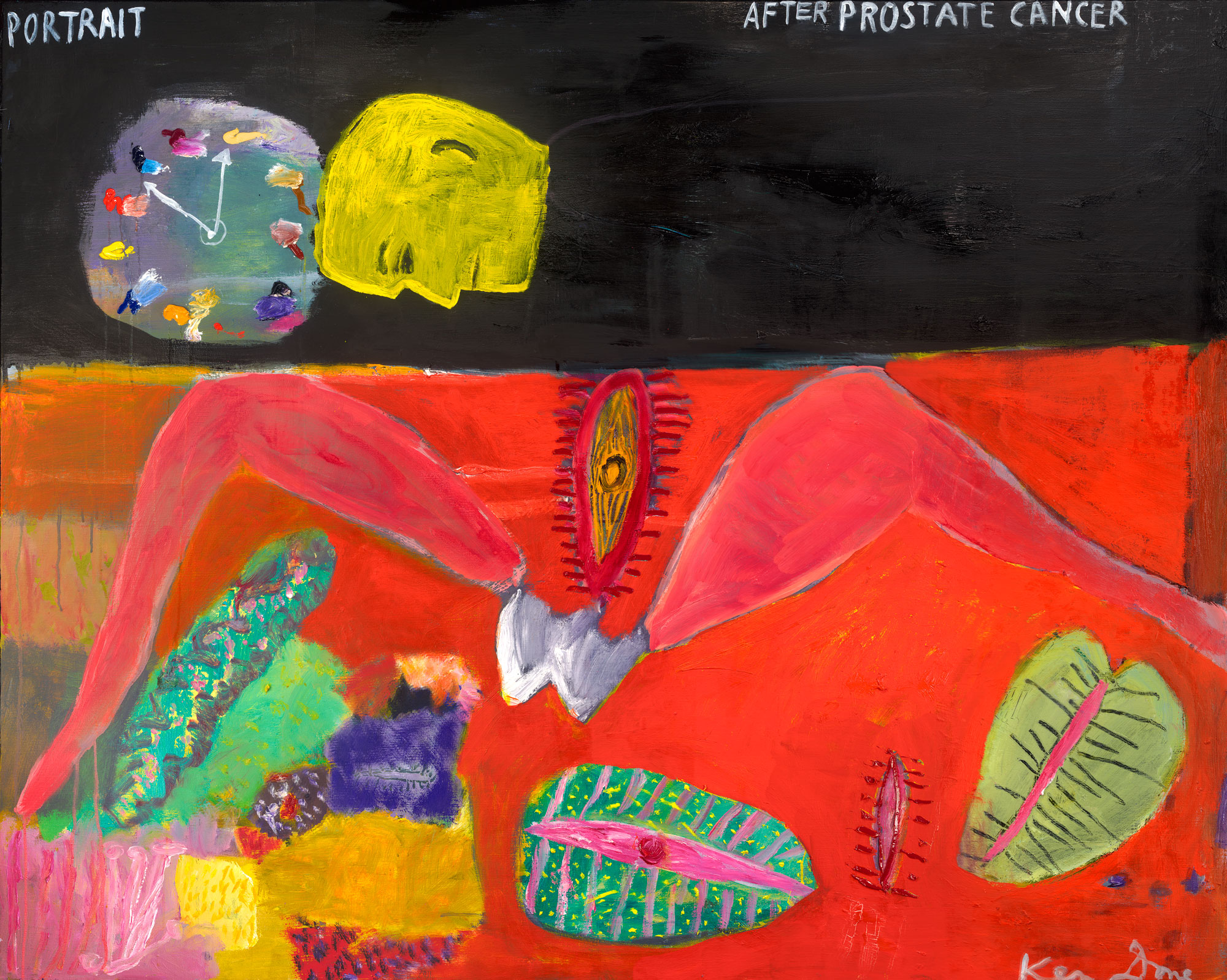 Portrait after prostate cancer